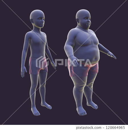 Obese boy before and after gaining weight, 3D illustration. Concept of obesity Obese boy before and after gaining weight, 3D illustration. Concept of obesity 128664965