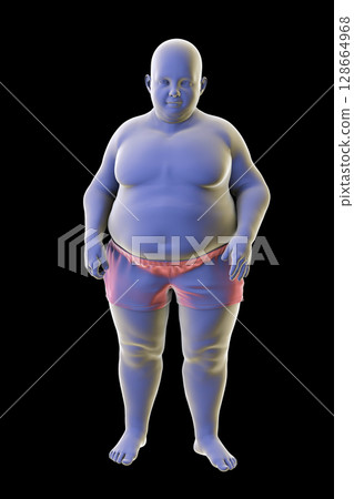 Obese boy, 3D illustration. Concept of obesity 128664968