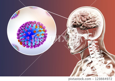 Influenza complication encephalitis 128664972