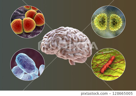 Etiology of bacterial meningitis 128665005