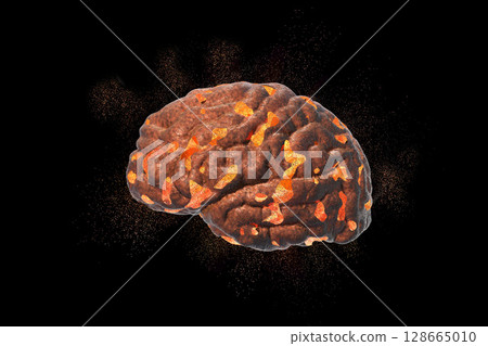 Brain destruction, medical concept for brain disease, burnout, depression, headache or migraine 128665010