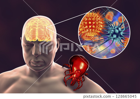Tick-borne encephalitis concept 128665045