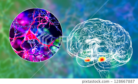 Amygdala, also known as corpus amygdaloideum, in the human brain Amygdala, also known as corpus amygdaloideum, in the human brain 128667887