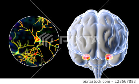Amygdala, also known as corpus amygdaloideum, in the brain Amygdala, also known as corpus amygdaloideum, in the brain 128667888
