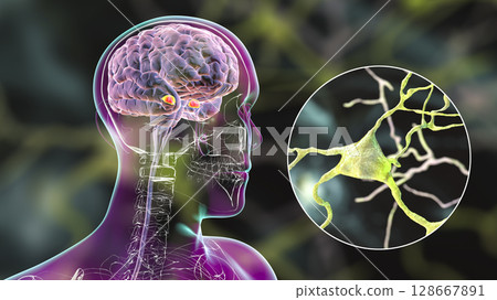 Amygdala in the brain, and closeup view of amygdala neurons, 3D illustration 128667891