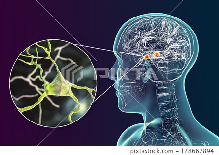Amygdala in the brain, and closeup view of amygdala neurons, 3D illustration 128667894