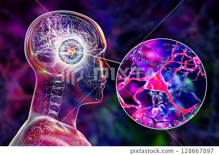 Amygdala in the brain, and closeup view of amygdala neurons, 3D illustration 128667897