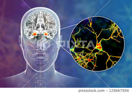 Amygdala in the brain, and closeup view of amygdala neurons, 3D illustration 128667898