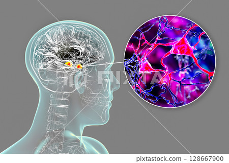 Amygdala in the brain, and closeup view of amygdala neurons, 3D illustration 128667900