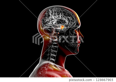 Amygdala, also known as corpus amygdaloideum, in the brain, 128667903