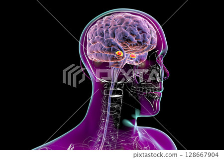 Amygdala, also known as corpus amygdaloideum, in the brain, 128667904