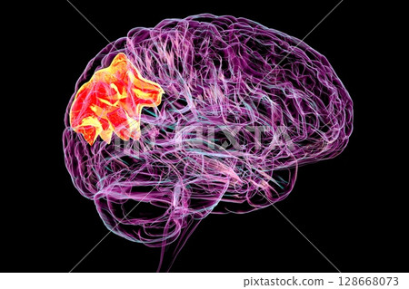 Human brain with highlighted precuneus gyrus, 3D illustration 128668073