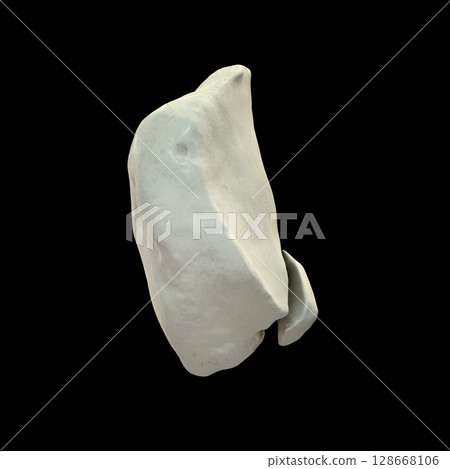 Patella osteochondral fracture, 3D illustration Patella osteochondral fracture, 3D illustration 128668106
