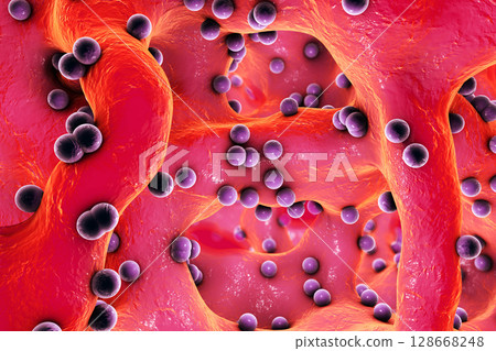 Spherical bacteria inside bone tissue 128668248