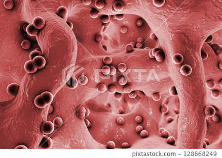 Spherical bacteria inside bone tissue 128668249