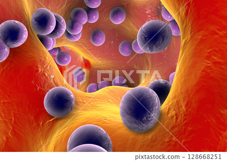 Spherical bacteria inside bone tissue 128668251