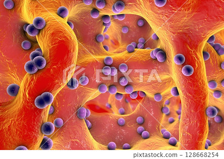 Spherical bacteria inside bone tissue 128668254