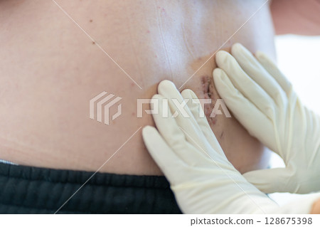 Medical Professional Examines Surgical Site on 128675398