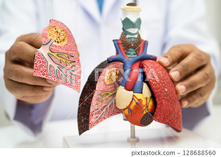 Pneumonia, lung cancer, Asian doctor holding human anatomy model for study diagnosis and treatment in hospital. Pneumonia, lung cancer, Asian doctor holding human anatomy model for study diagnosis and treatment in hospital. 128688560
