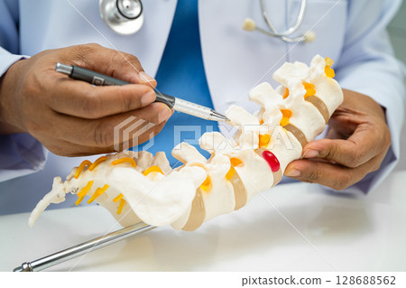Doctor with lumbar vertebra bone skeleton and nerve model for treatment in the orthopedic department. Doctor with lumbar vertebra bone skeleton and nerve model for treatment in the orthopedic department. 128688562
