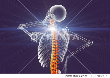 Neck pain, illustration 128703903