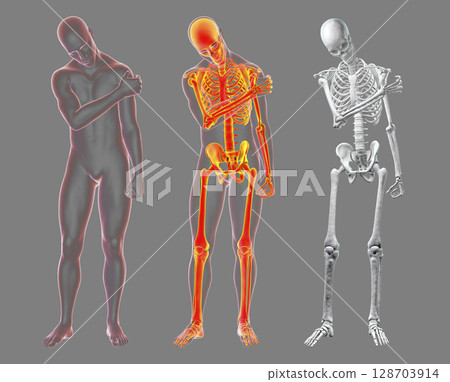 Shoulder pain, 3D illustration 128703914
