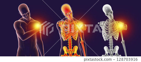 Shoulder pain, 3D illustration 128703916