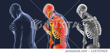 Shoulder pain, 3D illustration 128703920