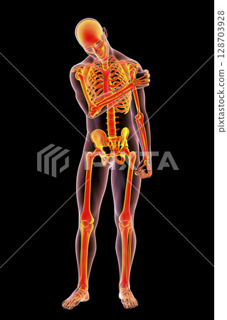 Shoulder pain, 3D illustration 128703928