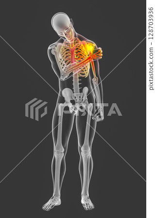 Shoulder pain, 3D illustration Shoulder pain, 3D illustration 128703936