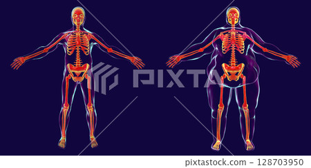 Obesity problem conceptual image 128703950