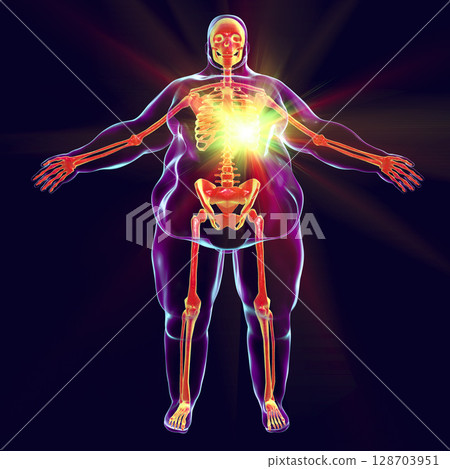 Heart disease in obesity 128703951