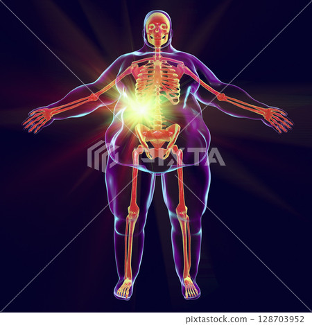 Liver disease in obesity Liver disease in obesity 128703952