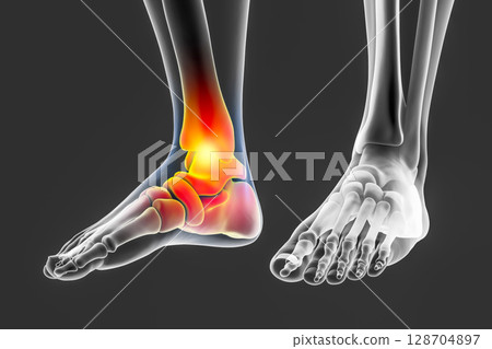Foot and ankle pain, conceptual 3D illustration Foot and ankle pain, conceptual 3D illustration 128704897