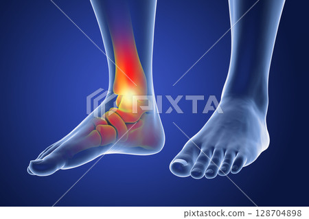 Foot and ankle pain, conceptual 3D illustration 128704898