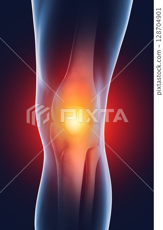 Painful knee, close-up view, anatomy and medicine concept 128704901