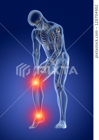 Foot and knee pain, 3D illustration Foot and knee pain, 3D illustration 128704902
