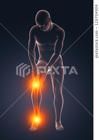Foot and knee pain, 3D illustration 128704904