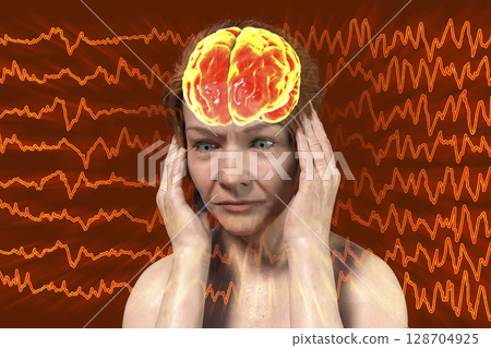 Headache, migraine, stroke, conceptual illustration showing a woman with pain in head on a background with migraine EEG waves Headache, migraine, stroke, conceptual illustration showing a woman with pain in head on a background with migraine EEG waves 128704925