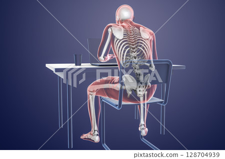Working with laptop in a wrong position. Concept of backache, back pain 128704939