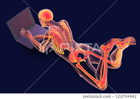 Working with laptop in a wrong position. Concept of backache, back pain Working with laptop in a wrong position. Concept of backache, back pain 128704942