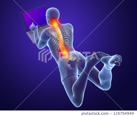 Working with laptop in a wrong position. Concept of backache, back pain 128704949