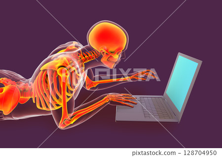 Working with laptop in a wrong position. Concept of backache, back pain 128704950
