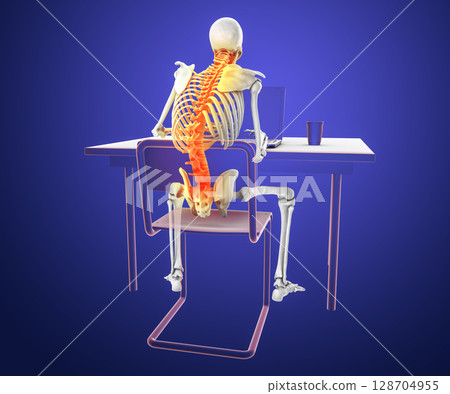 Working with laptop in a wrong position. Concept of backache, back pain 128704955