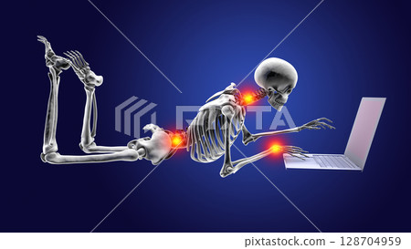 Working with laptop in a wrong position. Concept of backache, back pain 128704959
