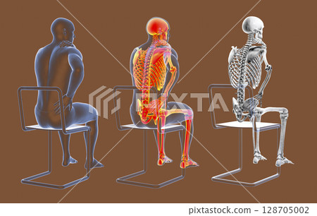 Human spine pain, backache, back pain 128705002