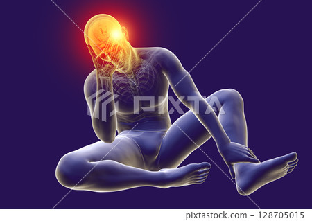 Headache, conceptual 3D illustration 128705015
