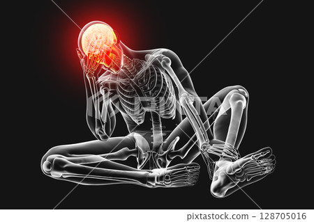 Headache, conceptual 3D illustration 128705016