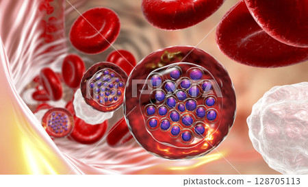 The malaria-infected red blood cells 128705113