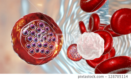The malaria-infected red blood cells 128705114
